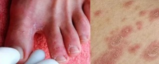 Anerer sprooch liesen